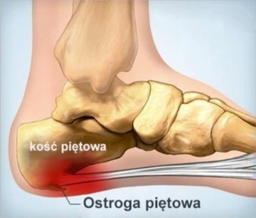 ПЯТОЧКА С СИЛИКОНОВЫМ ГЕЛЕМ Spur S