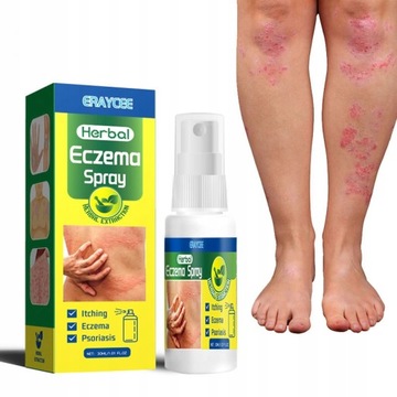 ERAYCEE Spray Do Leczenia Łuszczycy