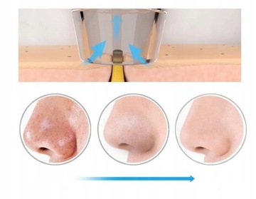 Пылесос M.na 2022 Wągry + Стамески для черных точек