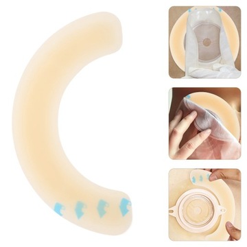 Клей для ухода за стомой Лента-кольцо Stoma 10 шт.