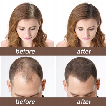 Витамин С для быстрого роста корней волос