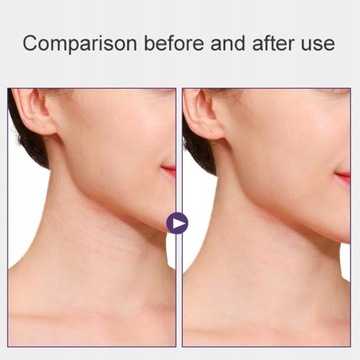 4x лента для подтяжки шеи, Beauty Neck, Lifting Sa