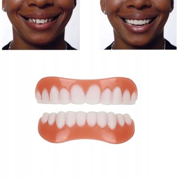 ИСКУССТВЕННЫЕ ЗУБЫ ИМПЛАНТАТЫ INSTANT SMILE