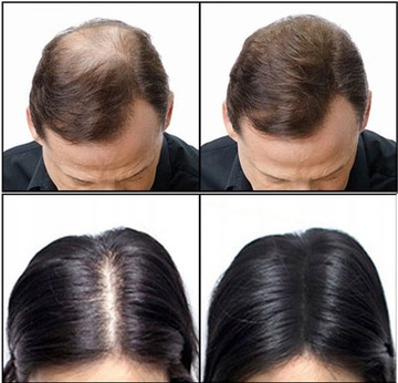 Севич Рефилл 50г Маскирующая косметика для редких волос в пакетике