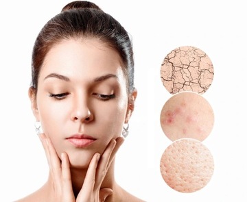 PEELING KAWITACYJNY SKUTECZNE URZĄDZENIE DO TWARZY 5W1 PEŁNY ZESTAW PREZENT