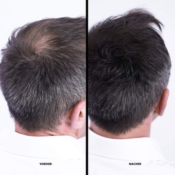 WŁÓKNA DO ZAGĘSZCZENIA WŁOSÓW KOLOR CZARNY