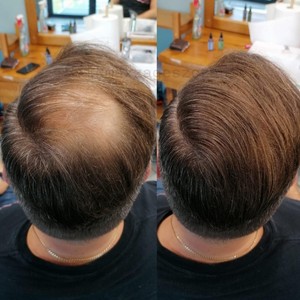 Kmax Microfibers для утолщения волос, 5 г, кератиновые волокна, натуральный, средний, коричневый