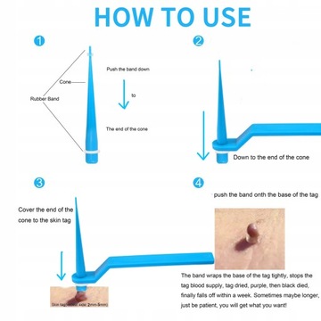 Tag skóry Zabij opaska do usuwania brodawek