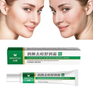 Эффективный крем для удаления прыщей, травяные пятна от прыщей, масло от прыщей