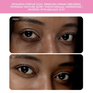 FOREO IRIS 2 Массажер для глаз, жемчужно-розовый