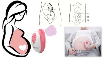 Medyczny Detektor tętna płodu ANGEL SOUNDS 3MHZ prezent na baby shower