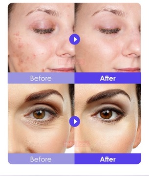 Профессиональная светодиодная лампа для фототерапии XRL СКЛАДНОЙ СПЕКТОМЕТР BODY FACE