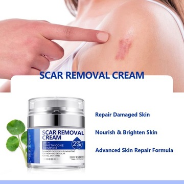 Scar Removal Cream 50ml Scar Lightening Repair