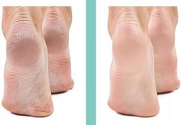Электрическая пилка для пяток PEDICURE USB