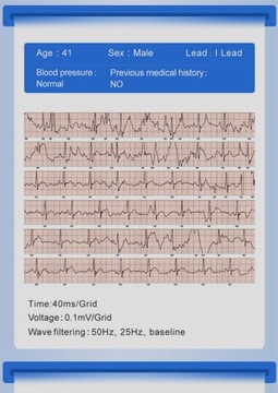 Умные часы Монитор сердечного ритма и артериального давления