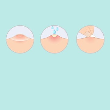 COSRX Acne Pimple Master 24 пластыря