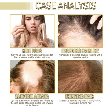 3 шт. 60 мл Масло для роста волос Розмарин.