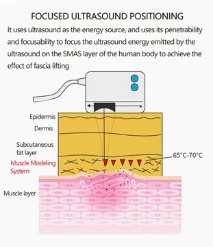 MINI HIFU PRO Лицо против старения, удаление морщин