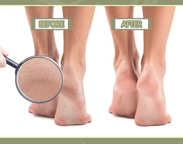 ПОДОДИСКИ МИКС 50 ШТ. ДЛЯ НАКЛАДОК МАНИКЮРА ПЕДИКЮРА