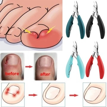 КЛИПСЫ ДЛЯ НОГТЕЙ Профессиональные кусачки для кутикулы для вросших ногтей на ногах.