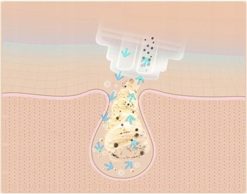 inFace Thermal Aqua Peel do Oczyszczania Twarzy