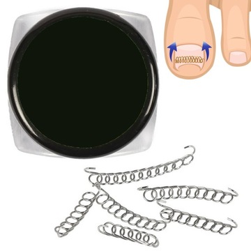 Корректирующий набор для вросших ногтей на ногах - брейк