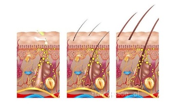 Спрей с сывороткой для активного роста с экстрактом имбиря