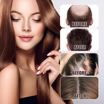 Продукты, стимулирующие рост волос Ginger Fast