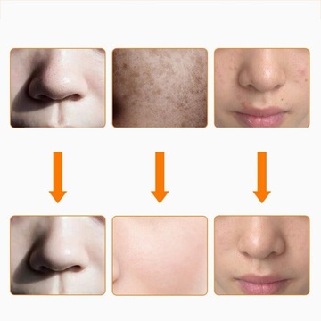 КРАСОТА МАСКА, АНТИВОЗРАСТНАЯ, ПРОТИВ АКНЕ, ЛИФТИНГ