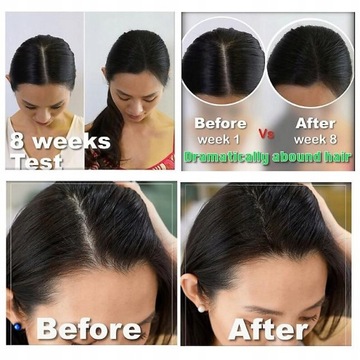 Шампунь от выпадения волос Шампунь для волос