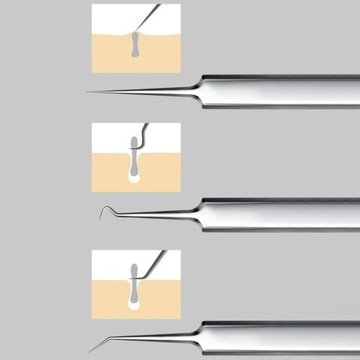 Пинцет для удаления черных точек. Удалите изогнутые черные точки.