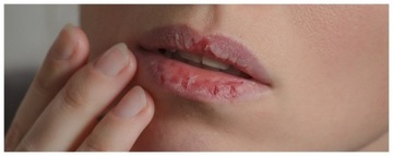 Биоваск для губ «Скорая помощь» 15 мл.