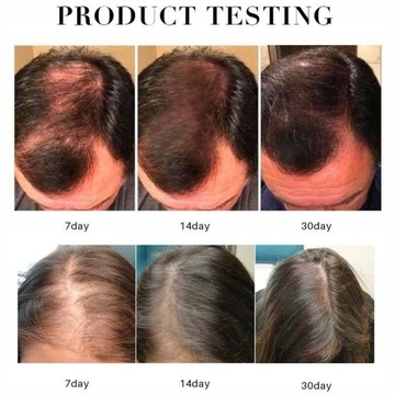 Сыворотка для роста волос