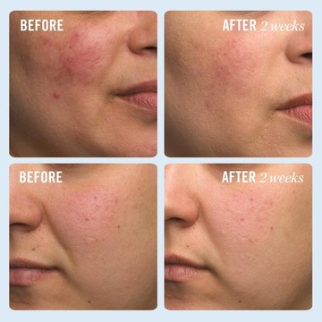 First Aid Beauty Ultra Repair Cream Интенсивно увлажняющий увлажняющий крем