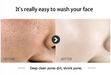 Гиалуроновая кислота, аминокислота, мягко очищает.