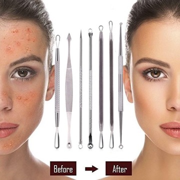 Łyżeczki Usuwania Wągrów Zaskórników Pryszczy 7szt