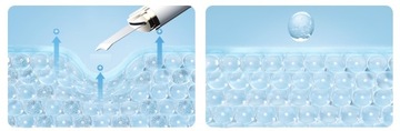 УЛЬТРАЗВУКОВОЙ ПИЛИНГ для кожи EMS Lifting ION+