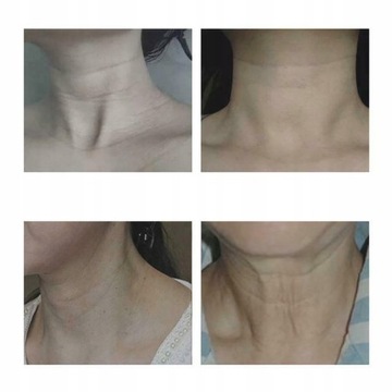 Массажер для шеи Уход за шеей Устранение морщин на шее