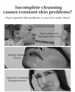 Płyn do demakijażu przeciwtrądzikowego z pędz