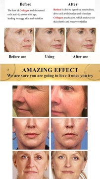 Крем для лица с ретинолом подтягивающий Лифтинг Антивозрастной уход от морщин