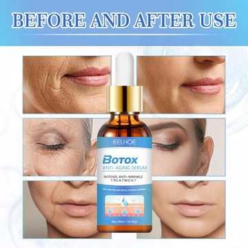 Восстановление глубоких морщин 30мл