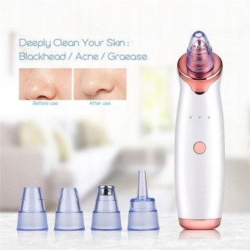 Ultrasonic Skin Scrubber Blackhead Remover Nano