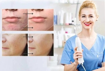 DERMA WAND ДАРСОНВАЛЬ 7 ПЕЛОТ 30ВТ САМЫЙ СИЛЬНЫЙ