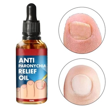 Kuracja na Wrastające Paznokcie Olejek Odżywc