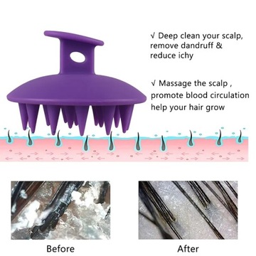 Щетка для кожи головы Силиконовый скребок для волос Щетка для душа Щетка для головы от перхоти Удалить полностью