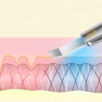 NEFRELUMI Кавитационный пилинг 5в1 LED Ионофорез Ems Sonophoresis лифтинг-тоник