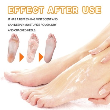 3 szt. Spray do usuwania zrogowaceń na piętach 30 ml nawilżający TW