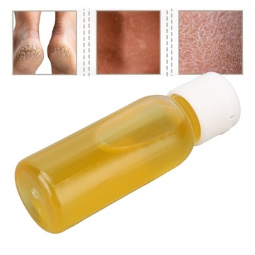 Желтое масло для пилинга, отбеливающее, мягкое, удаление мозолей
