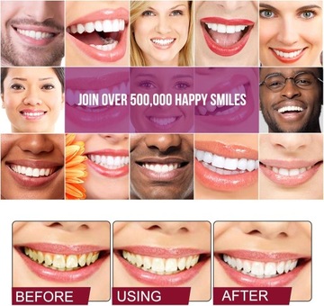 2 шт. Ультра отбеливающая зубная паста SP-6, отбеливающая зубная паста с пробиотиками SP-6