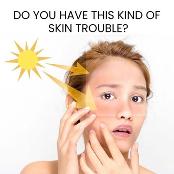 Солнцезащитные кремы EELHOE Sun Protect удаляют темные пятна